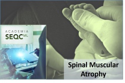 Importance of neonatal screening for spinal muscular atrophy